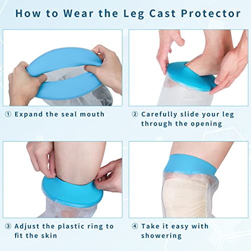SUPERNIGHT Waterproof Knee Cast Cover for Shower Adult, Watertight Reusable Cast Protector for Knee/Leg After Surgery, Wound, Bandage, Burns Broken Replacement Protection - Image 3