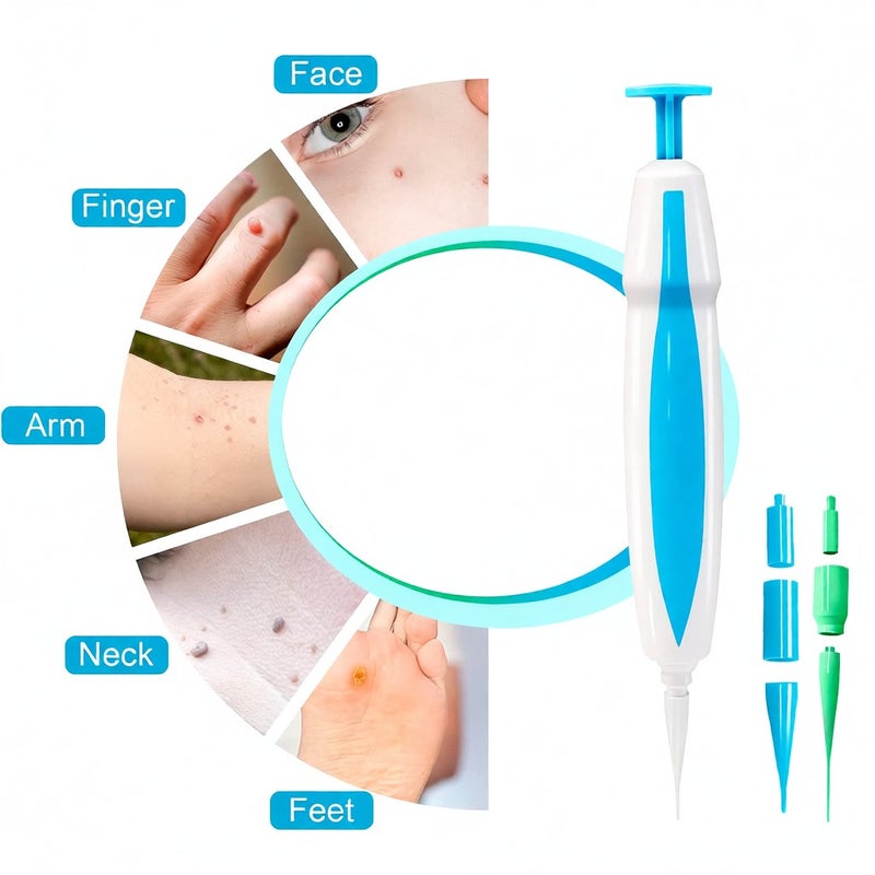 Remove Skin Tag Pen Facial Care Nevus Tool 1mm-8mm Remove Meat Nevus Corns Warts Skin Tag Removal Tool Replaceable Head - Image 4