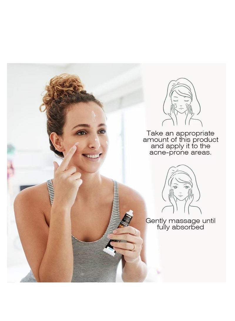 سوميفون جل سوميفون بي فينوم المضاد لحب الشباب، جل إزالة حب الشباب 20 جرام. - Image 5