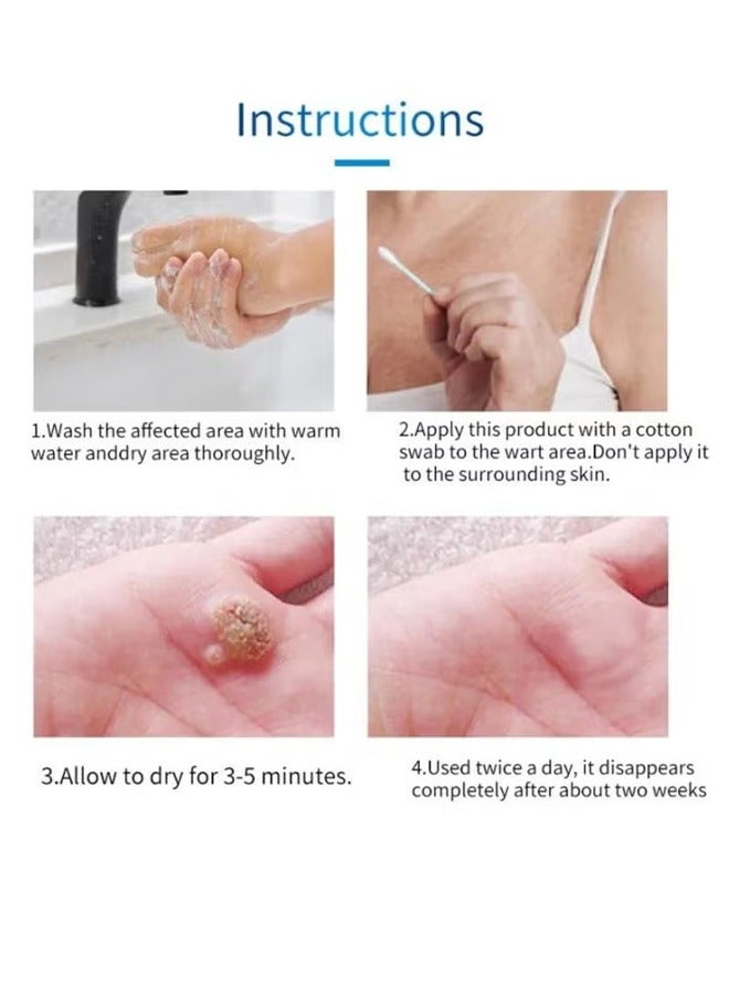 هيلموسز سائل إزالة الثآليل، لوشن إصلاح لإزالة الثآليل والشامات، سهل الاستخدام لإزالة علامات الجلد بشكل آمن وفعال، محلول سائل لإزالة الثآليل - 10 مل - Image 5