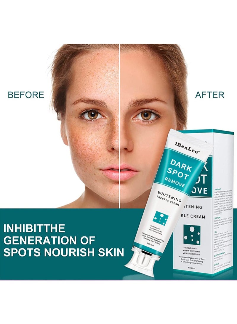 iBealee Dark Spot Remover for Face Peeling Skin Whitening Freckle Cream Pigmentation Treatment Sun Spots Age Spots Freckle Blemish Remover Lightening Cream- 2 Pcs  - Image 2