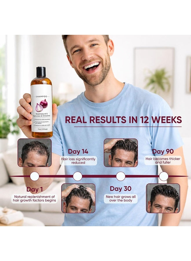 شامبو البصل لنمو الشعر، زيت إكليل الجبل ومستخلص البصل الأحمر والقرفة، شامبو مضاد لتساقط الشعر، عناية مغذية، يعزز كثافة الشعر للنساء والرجال. (200 مل) - Image 5
