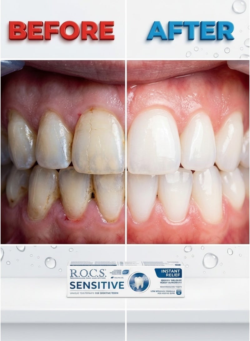 رينيه فورتيرير معجون أسنان R.O.C.S. الحساس للراحة الفورية وإعادة تمعدن المينا، خالٍ من الفلورايد مع هيدروكسيباتيت و8% إكسيليتول، تركيبة منخفضة الكشط للعناية اللطيفة، 94 جرام - دعم متقدم للعناية بالفم وتقليل حساسية الأسنان ونفس منعش. - Image 3