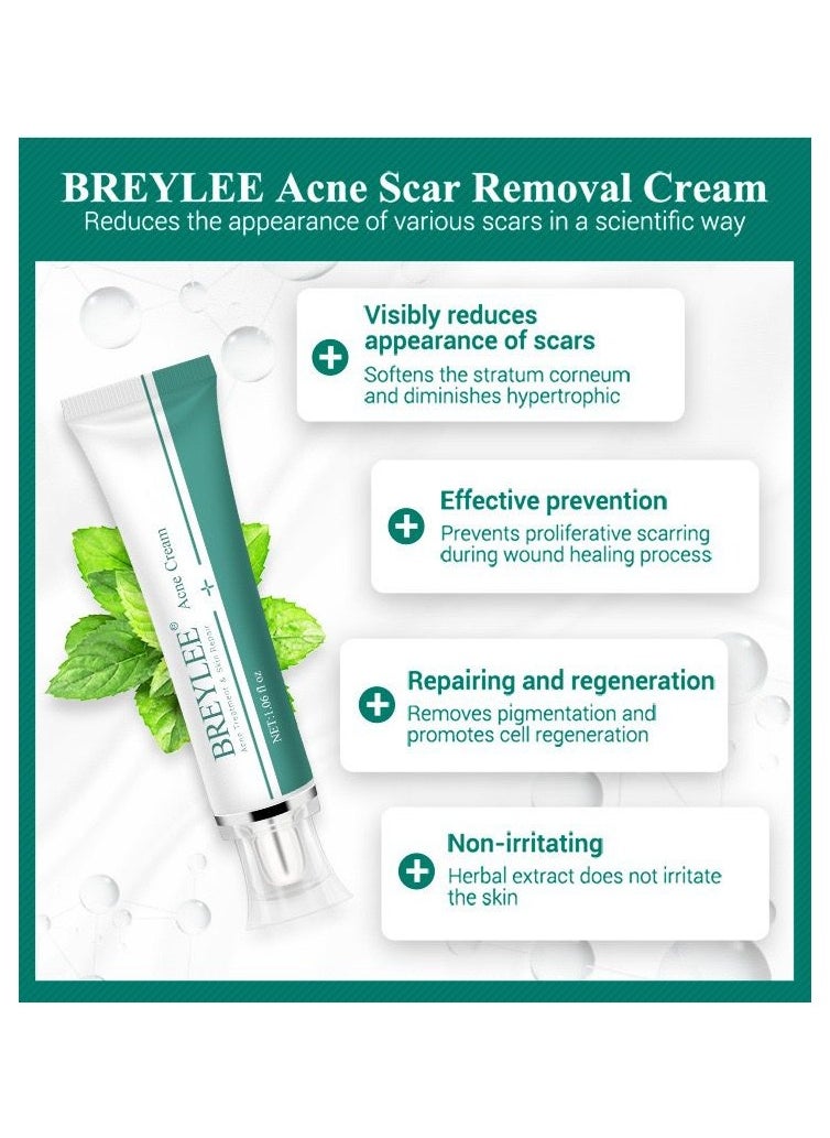 Acne Removal Face Cream Skin Repair Care Remove Stretch Marks Whitening Cream (30g) - pzsku/ZF4428747DB2E7A9C324EZ/45/_/1716815443/3d7fd4fc-8fee-4c17-851c-7a847eb7a2d6