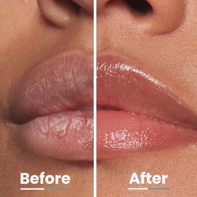 HYPHEN All I Need Lipscreen with Spf 30 & 2% Kojic Acid -Moisturizing, Sun Protection|Smooth Lips, Tan Removal for Women and Men|Lip Balm Spf|Chapped Dry Lips | Peptide|Vegan,Sls & Paraben-Free -10 Gm - Image 5