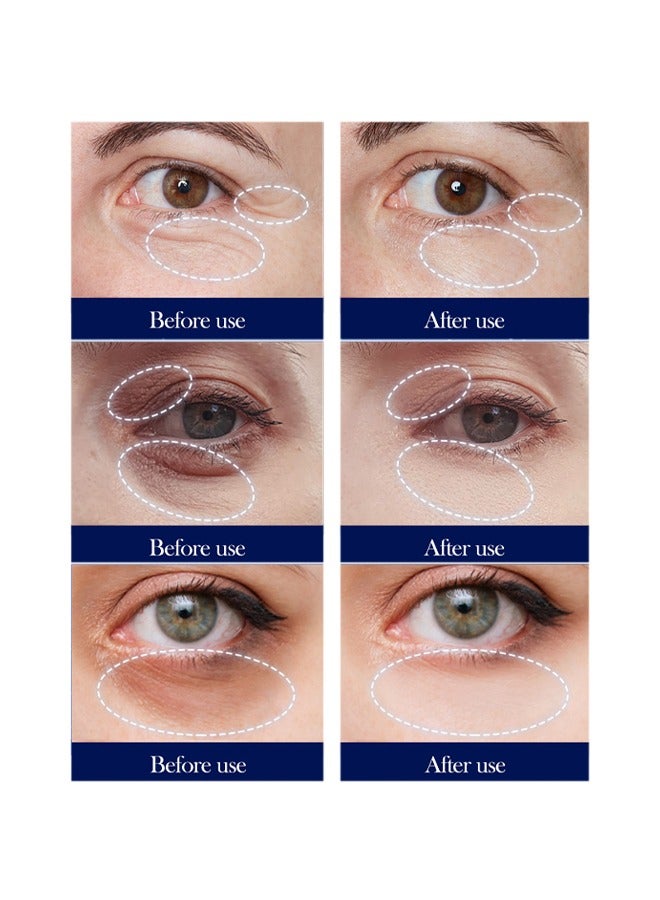 SADOER Caffeine Anti-Wrinkle Firm Eye Cream，for Dark Circles and Puffiness - Dark Circles Under Eye Treatment Serum to Reduce Wrinkles, Fine Lines, and Eye Bags, Hydrate Eye Area 20g - Image 3