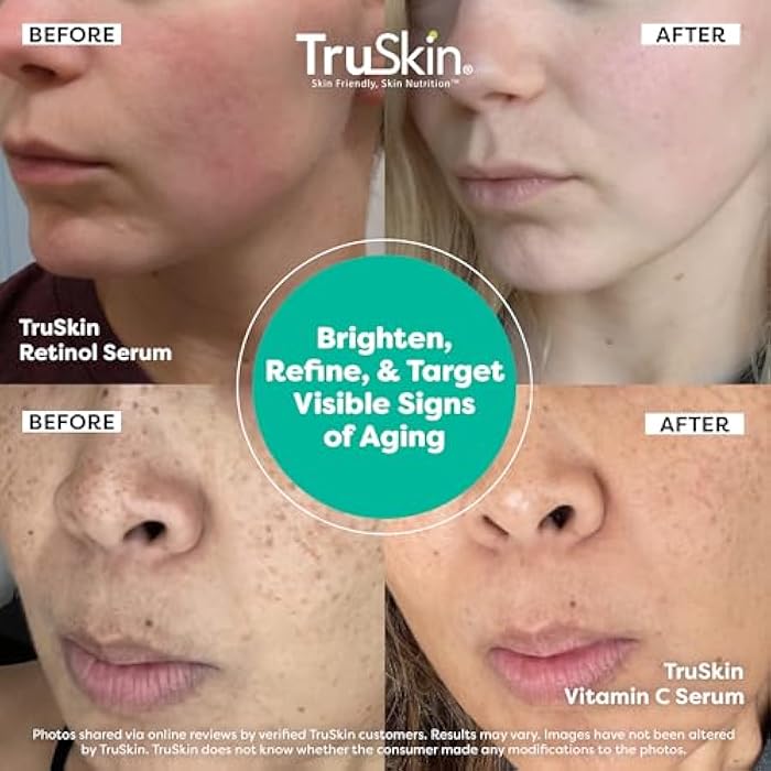 TruSkin Face Serum Duo – Vitamin C & Retinol Serum for Face – Anti-Aging Skin Care Gift Set for Women – Helps Improve Appearance of Fine Lines & Wrinkles for Smoother Looking Skin, 1 Fl Oz, 2 Bottles - Image 4