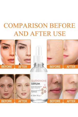glutathione serum before and after 25% Vitamin C + For Uneven Skin Tone Glutathione 7 Dark Spot Serum