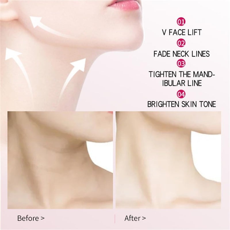 V-Line Lifting Bandage Mask, Double Chin Reducer, Face Lifting Chin Strap for Women, V-Line Shaping Mask, Cheek and Neck Patch, 5PCS - Image 1