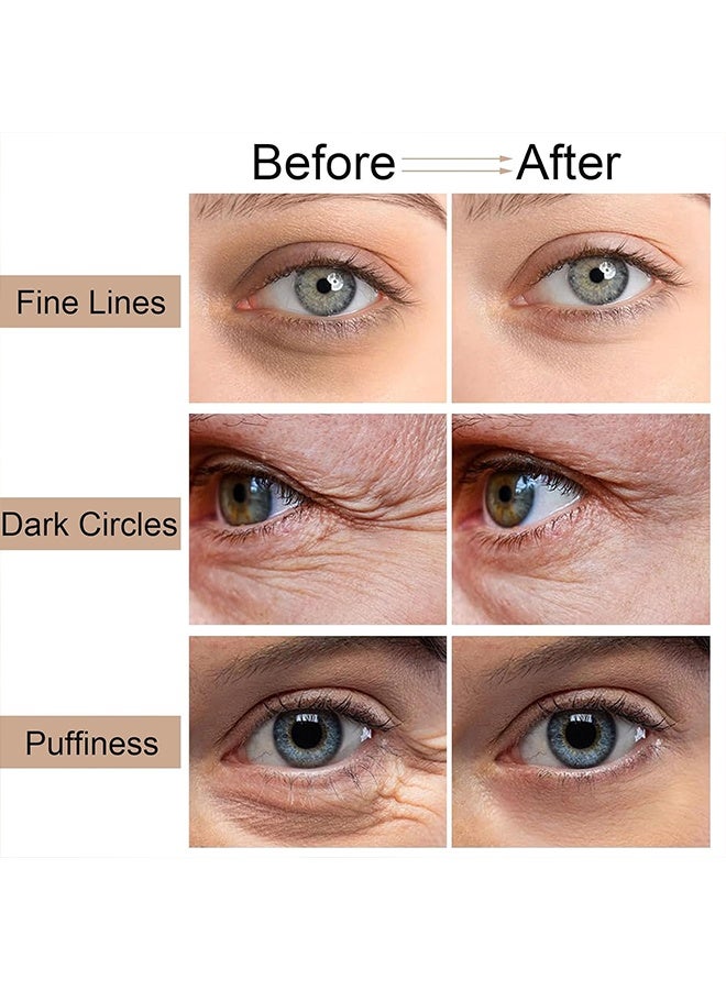 روزينو قلم كريم العين بالكافيين، للهالات السوداء، مضاد للتقدم في السن، والانتفاخات والخطوط الدقيقة، سيروم للعين للانتفاخات، كريم تحت العين مضاد للشيخوخة، ليُنعّم الخطوط الدقيقة ويرطب منطقة العين، عناية ببشرة العين للنساء والرجال، قطعة واحدة - Image 5