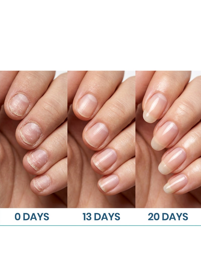 Avens Cosmetics Keranaily Nail Serum_ The Best Nail Strengthening Serum 5ml - Image 4