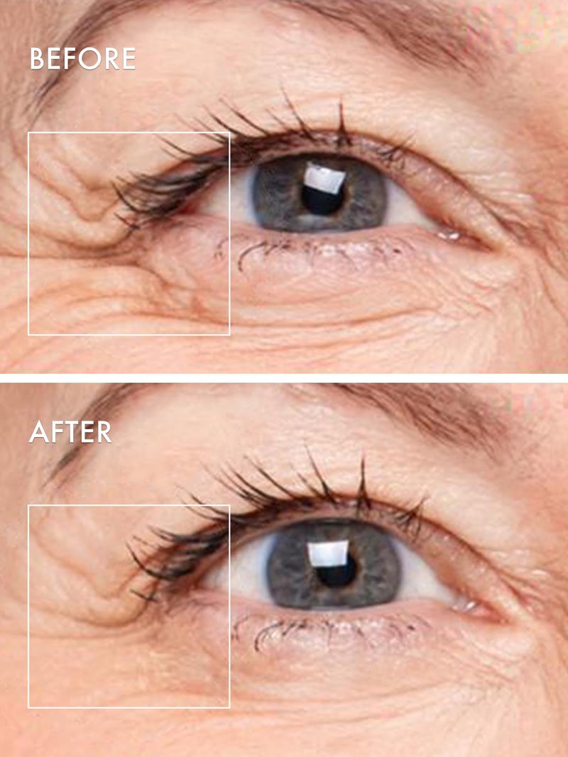 depology Deepcare+ Serum-Infused Micro Dart Patche | 4 Pairs Eye Mask | Under Eye Patches for Wrinkles | Fine Lines | Hydrating Eye Mask with Peptides | Amino Acids | and Synthesized Molecules - Image 5