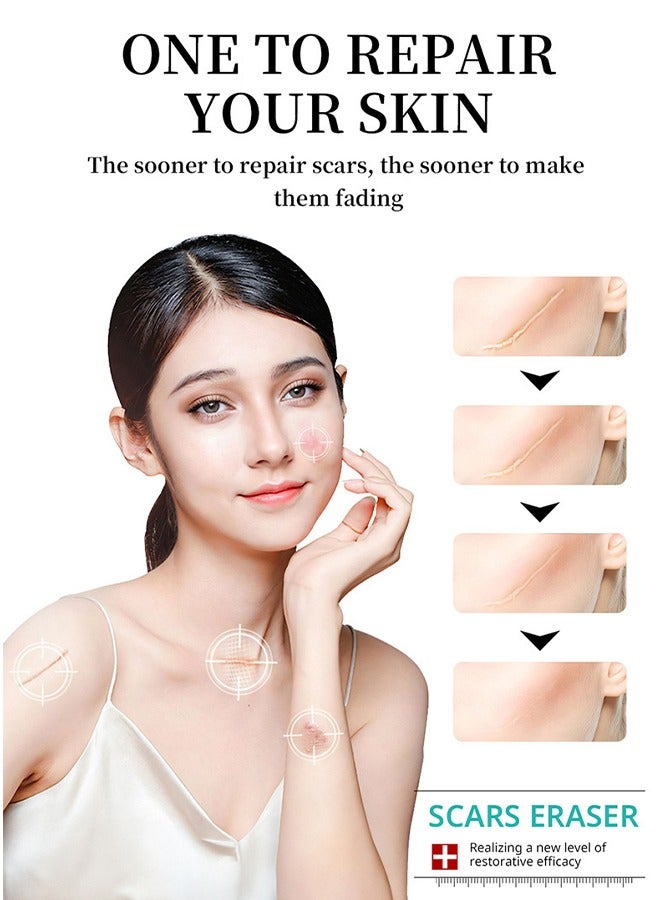 MAYCHEER Scar Cream -  50g Advanced Scar Gel Soften and Flattens Scars Resulting from Surgery Injury Burns Natural Scar Treatment for Face & Body - Image 5