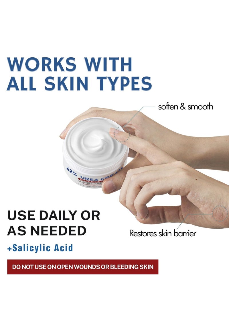 OUKEYA - 150g 42% Urea Cream Salicylic Acid Cream for Cracked Feet Hands Callus Remover Hand Cream Foot Cream for Cracked Foot Heels Elbows Nails Knees Skin Moisturizer Urea Lotion with Maximum Strength - Image 1