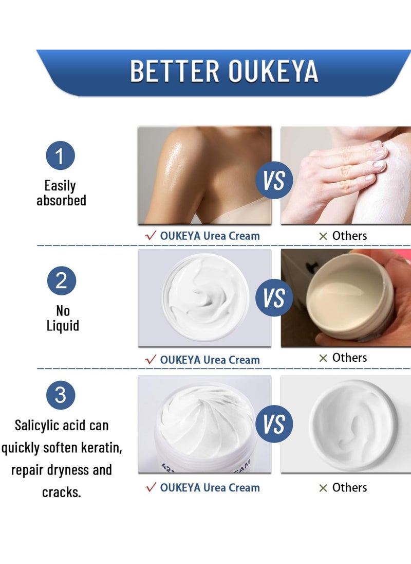 OUKEYA - 150g 42% Urea Cream Salicylic Acid Cream for Cracked Feet Hands Callus Remover Hand Cream Foot Cream for Cracked Foot Heels Elbows Nails Knees Skin Moisturizer Urea Lotion with Maximum Strength - Image 1