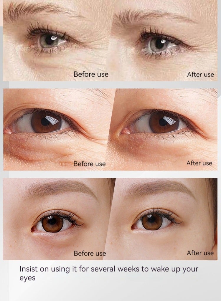 ASIV Electric eye treatment device with red light for facial and neck treatment | Four-in-one light therapy massager | Revitalize collagen protein | Remove wrinkles and anti-aging | Portable rechargeable - Image 5