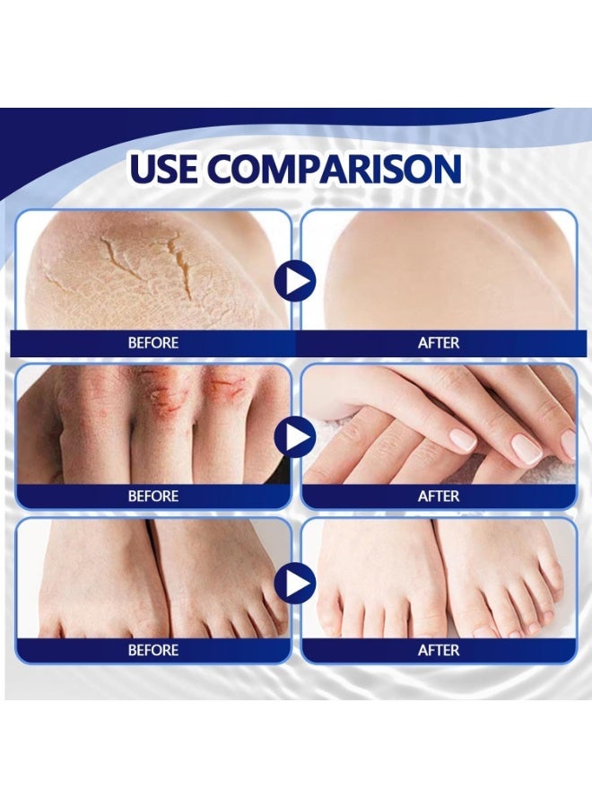 DERMFREE Urea Cream 40 Percent, Deep Moisturizing, Foot Cream, Feet Deep Moisturizing Nourishing Formula, Repair & Daily Care, Feet Hard Skin Remover for Rough, Dry, Thick Skin, Callus Remover - Image 3