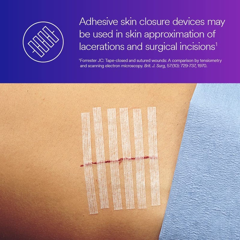 3Mâ„¢ Steri-Stripâ„¢ Reinforced Adhesive Skin Closures, R1546, 1/4 in x 4 in (6 mm x 100 mm), 50 Bag/Carton, 4 Carton/Case - Image 5