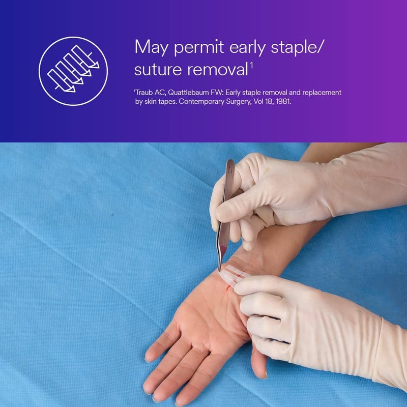 3Mâ„¢ Steri-Stripâ„¢ Reinforced Adhesive Skin Closures, R1546, 1/4 in x 4 in (6 mm x 100 mm), 50 Bag/Carton, 4 Carton/Case - Image 4