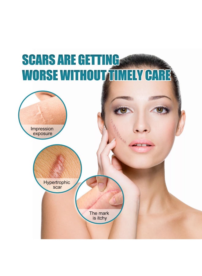 WEST MONTH & Month Self-adhesive Silicone Skin Patch Skin Smooth Skin Care Patch - Image 4