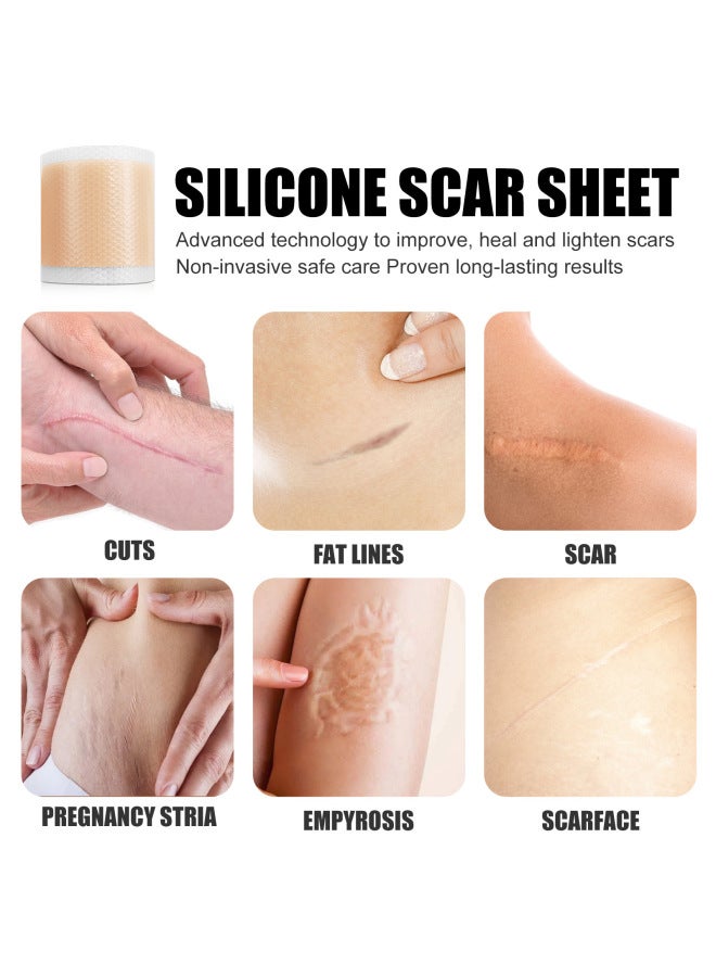 WEST MONTH & Month Self-adhesive Silicone Skin Patch Skin Smooth Skin Care Patch - Image 3