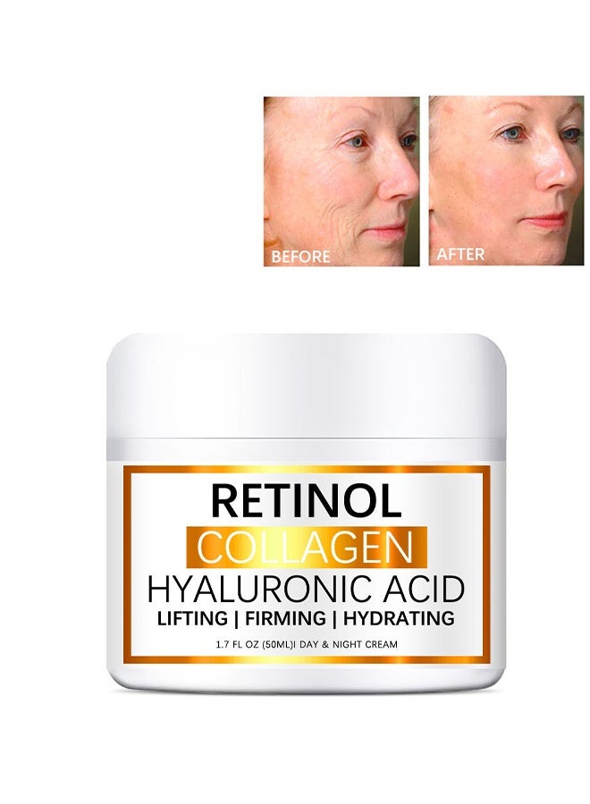 Retinol Collagen Cream for Face, Anti-Aging Moisturizer with Hyaluronic Acid & Vitamin E, Collagen Cream for Wrinkles & Dark Spots, Night Cream for Youthful Skin