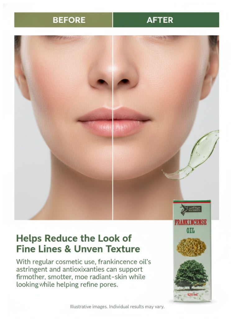 SILK SMOOTH Pure Frankincense Oil for Face - Natural Elixir Infused with Nutrients for Radiant Skin, Cold-Pressed for Ultimate Purity and Nourishment - Image 5