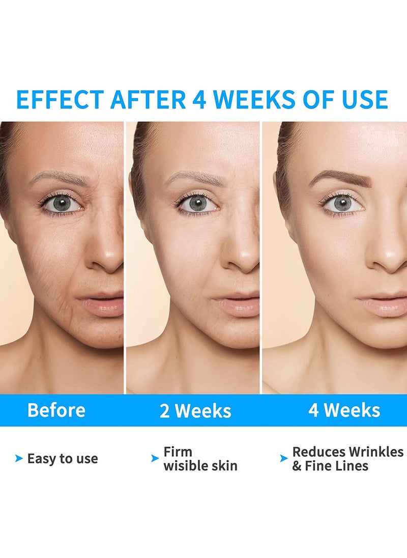 MarlaMall - Double Chin Reducer Machine, 6 Modes and 12 Intensity Levels Electric Double Chin Eliminator,Smart Double Chin Face Lift Device with Magnetic Massage, V Face Beauty Device for Woman - Image 1