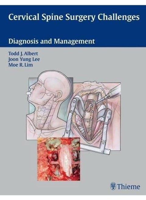 Cervical Spine Surgery Challenges