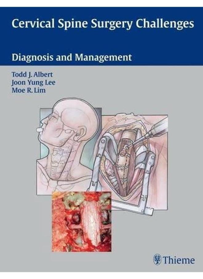 Cervical Spine Surgery Challenges