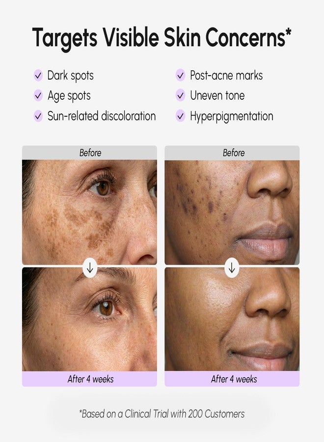 MAREE Dark Spot Remover for Face and Body – Dark Spot Corrector Serum – Hyperpigmentation, Melasma, Sun & Age Spots – Black & Brown Spot Remover for Women – Crema para Manchas Oscuras en la Cara - Image 3