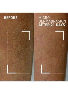 Dr. Brandt Skincare Dr. Brandt Microdermabrasion Body Polishing Exfoliator Targets Rough Dull And Dry Skin Improves Overall Appearance Of Body Skin 4.4 Oz  - Image 5