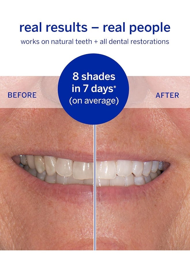 Supersmile شرائط تبييض الأسنان المحترفة سوبر سمايل القابلة للذوبان آمنة للمينا لتبييض الأسنان الحساسة - Image 3