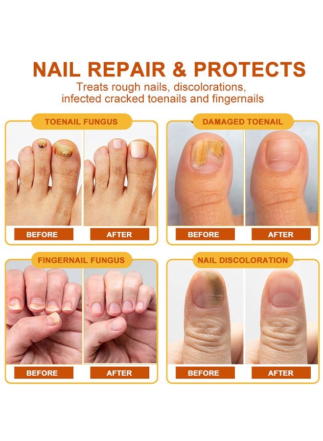 Sumifun Bee Venom Nail Repair Cream - Nail Growth Care Nail Repair Cream Improve Nail Thickening Brittleness Yellowing And Other Problems 20g - Image 5