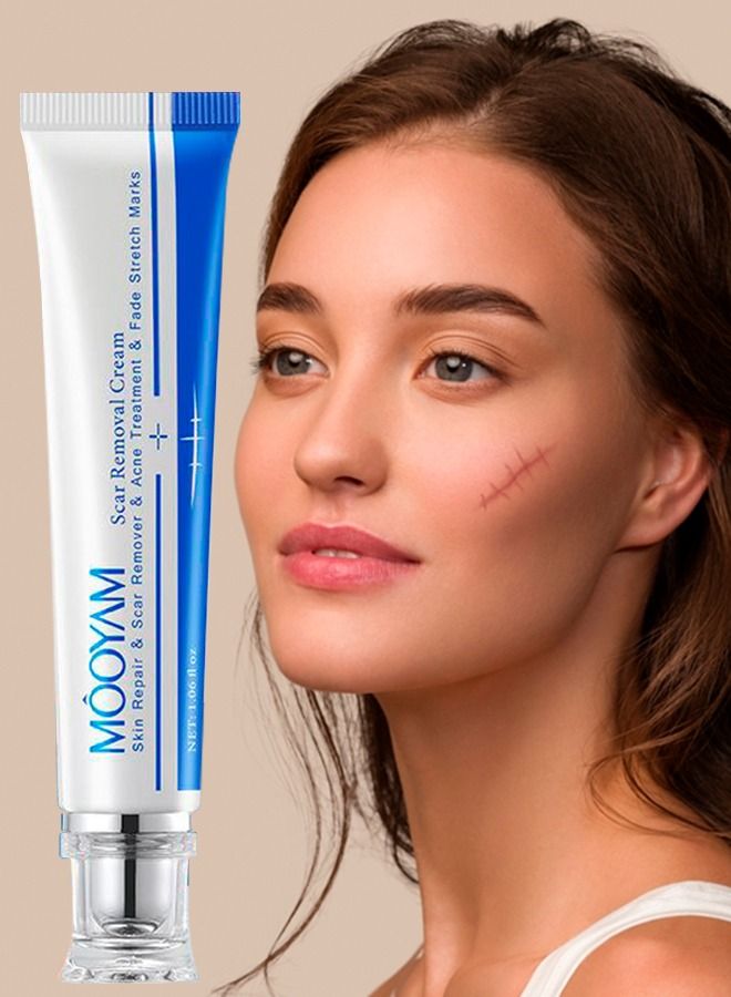MOOYAM Scar Removal Cream Acne Scar Cream Rapid Repair Scar Cream for Acne Surgery Injury Burns Advanced Gel Acne Scar Spot Treatment Suitable for All Skin Types 30g  - Image 1
