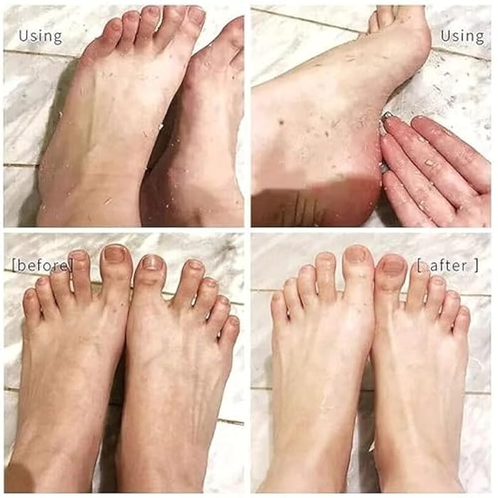 When!e.g., Soft Feet, Touch Fast, Soft Touch, New Skin, Speed of Rejuvenation, Foot Freshness. - Generic - Image 3