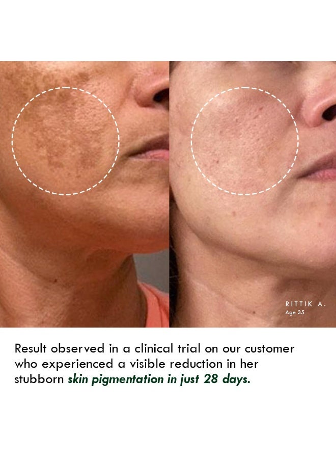 AULI LIFESTYLE Retinuit 0.3% Retinol Face Oil for Anti - Ageing, Reduce Fine Lines & Wrinkles, for Women, All Skin Type, 30ML - Image 3