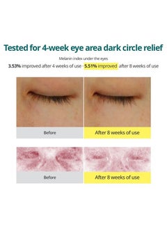 Goodal Green Tangerine Vitamin C Eye Cream - Dark Circle Relief, Elasticity Treatment, Gentle Anti-Aging & Anti-Wrinkle Care (1.01oz)  - Image 5