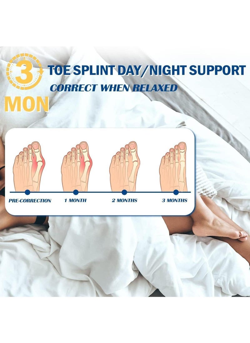 Sweet seven Bunion Corrector Bunion Splint Orthopedic Big Toe Straightener Non-Surgical Hallux Valgus Correction Hammer Toe Straightener Toe corrector for Pain Relief Fits Men and Women  - Image 5