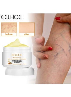 Vitamin K Varicose Veins Cream, Soothing Leg Cream, Varicose and Spider Veins Treatment Cream, Improve Blood Circulation, Fast Relieve Swelling Pain 60g
