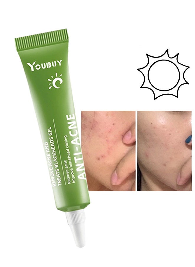 YOUBUY Anti - Acne Cream,Remove Acne and Treats Blackheads Gel ,Remove Acne Pimple and Treats Blackhead with Azelaic Acid Oil, Control Shrink Pores Redness ,Acne Remover Cream,Day Use 20g - Image 1