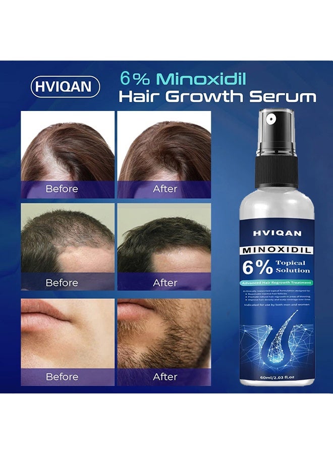 Hviqan 6% Minoxidil Topical Solution，Hair Growth Spray For Men and Women 60Ml Hair Regrowth Treatment Serum For Stronger Thicker Longer Hair Help to Stop Thinning and loss hair 60ml - Image 2