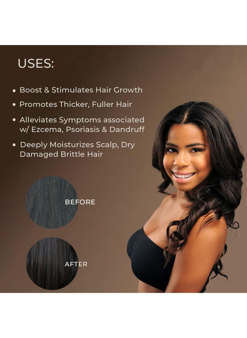 صاني آيل زيت الخروع الجامايكي الأسود المكثف من ساني آيل 6 أونص | علاج طبيعي 100٪ عالي الفعالية للشعر وفروة الرأس - Image 3