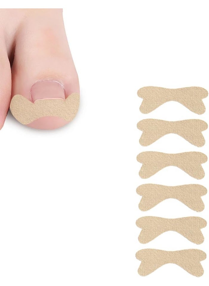 50 قطعة من لاصقات علاج أظافر القدم الغارزة في اللحم، ملصقات تصحيح أصابع القدم، أداة سريعة لإصلاح أظافر القدم الغارزة في اللحم - Image 2