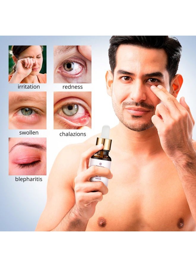 Roycederm Stye Eye Treatment Serum: Natural Stye Remover for Styes Chalazion and Blepharitis - Safe & Fast Relief - Image 5