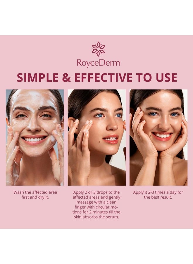 Roycederm Stye Eye Treatment Serum: Natural Stye Remover for Styes Chalazion and Blepharitis - Safe & Fast Relief - Image 4