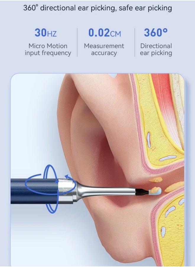 Ru syanl - 4 in 1 Visual Ear Wax Removal Tool Smart Ear Cleaner With Tweezer and Camera for IOS and Android - Image 1