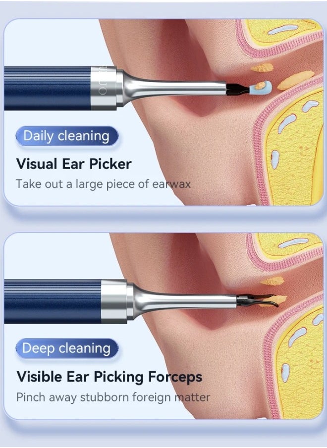 Ru syanl - 4 in 1 Visual Ear Wax Removal Tool Smart Ear Cleaner With Tweezer and Camera for IOS and Android - Image 1
