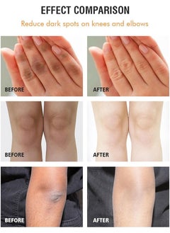 MOOYAM Whitening Cream for Correcting Dark Spots, Safe Armpit Moisturising Cream Lighten Melanin 120g - Practical Bleaching Body Lotion for Armpits, Neck, Knee, Elbow, Inner Thigh, Intimate Area  - Image 4