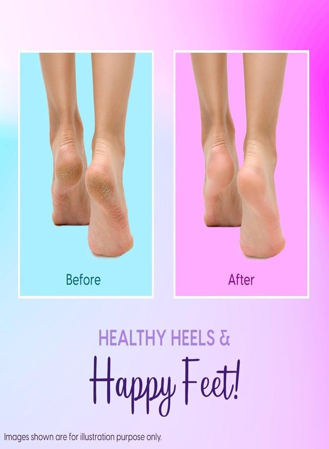 Matra Silicone Gel Heel Socks (1 Pair) - Half Length, Moisturizing Cotton Socks with Vented Design - Unisex Anti-Crack Heel Repair Sock (Free Size) - Image 5